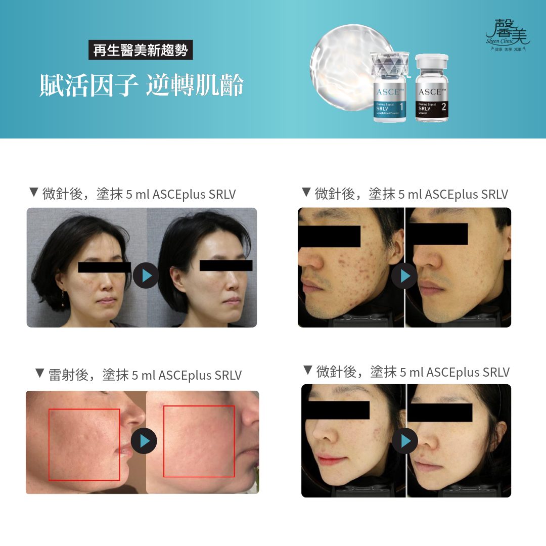 魔煥｜魔泌外泌體｜使用後的對比照