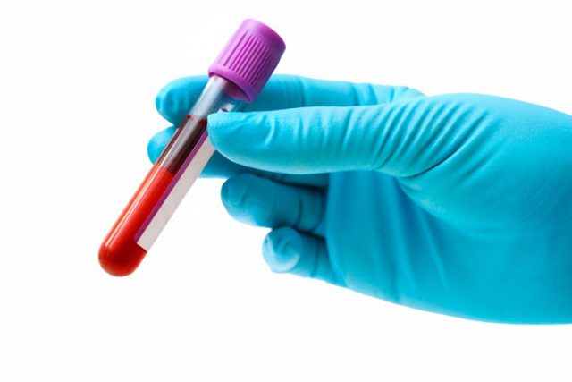 blood-test-in-a-test-tube